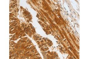 Immunohistochemistry (IHC) image for anti-Complement Factor H-Related 1 (CFHR1) (AA 151-330) antibody (ABIN6219787) (CFHR1 Antikörper  (AA 151-330))