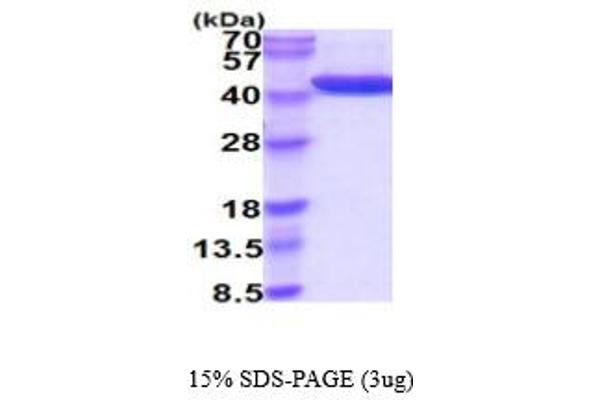 ADH1A Protein (AA 1-375) (His tag)