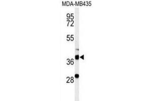 Western Blotting (WB) image for anti-Dehydrogenase/reductase (SDR Family) Member 7 (DHRS7) antibody (ABIN3002129)