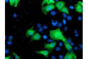 Anti-NEK9 mouse monoclonal antibody (ABIN2454885) immunofluorescent staining of COS7 cells transiently transfected by pCMV6-ENTRY NEK9 (RC211326). (NEK9 Antikörper)