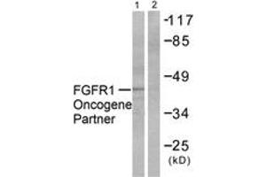 Western blot analysis of extracts from HepG2 cells, using FGFR1 Oncogene Partner Antibody. (FGFR1OP Antikörper  (AA 341-390))