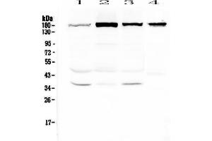 Western blot analysis of IQGAP2 using anti-IQGAP2 antibody . (IQGAP2 Antikörper  (AA 1329-1544))