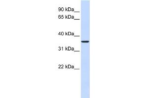 WB Suggested Anti-FBP2 Antibody Titration:  0. (FBP2 Antikörper  (Middle Region))