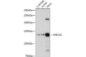 Western blot analysis of extracts of various cell lines, using  antibody (ABIN7265603) at 1:1000 dilution. (ANKLE2 Antikörper  (AA 350-450))
