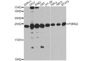 Western blot analysis of extracts of various cell lines, using PSMB2 antibody (ABIN6291444) at 1:1000 dilution. (PSMB2 Antikörper)