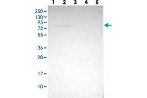 Western blot analysis of Lane 1: RT-4, Lane 2: U-251 MG, Lane 3: Human Plasma, Lane 4: Liver, Lane 5: Tonsil with ZMAT1 polyclonal antibody . (ZMAT1 Antikörper)