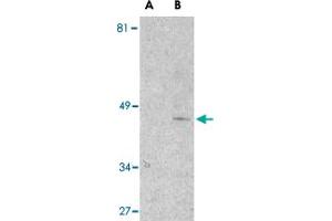 Western blot analysis of Il1rl1 in mouse kidney lysate with Il1rl1 polyclonal antibody  at 1 ug/mL in the presence (lane A) or absence (lane B) of 1 ug blocking peptide. (IL1RL1 Antikörper  (N-Term))