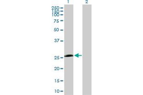 PSMB5 Antikörper  (AA 1-263)
