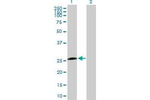 Western Blot analysis of PSMB5 expression in transfected 293T cell line by PSMB5 MaxPab polyclonal antibody.