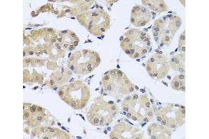 Immunohistochemistry of paraffin-embedded Human stomach using CDC45 Polyclonal Antibody at dilution of 1:100 (40x lens). (CDC45 Antikörper)