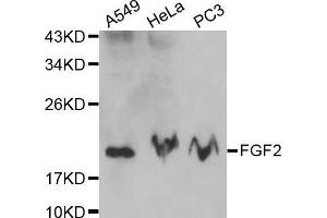 Western blot analysis of extracts of various cell lines, using FGF2 antibody. (FGF2 Antikörper  (AA 143-288))
