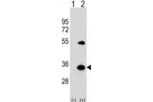 Western Blotting (WB) image for anti-ATG5 Autophagy Related 5 (ATG5) antibody (ABIN2999975) (ATG5 Antikörper)