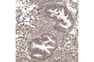 Immunohistochemical staining of human corpus, uterine with CRIP3 polyclonal antibody  shows moderate membranous and cytoplasmic positivity in glandular cells. (CRIP3 Antikörper)