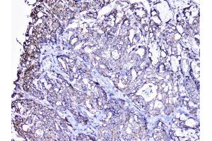 IHC analysis of cortactin using anti-cortactin antibody (ABIN6719306).