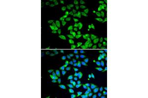 Immunofluorescence analysis of U20S cell using MAP1LC3B antibody.