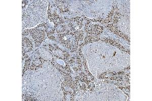 IHC analysis of TRMT6 using anti-TRMT6 antibody (ABIN7602138).