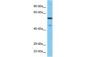 Host:  Rabbit  Target Name:  NEK11  Sample Type:  721_B Whole Cell lysates  Antibody Dilution:  1. (NEK11 Antikörper  (Middle Region))