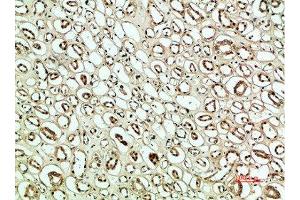 Immunohistochemical analysis of paraffin-embedded human-kidney, antibody was diluted at 1:200 (PLK2 Antikörper  (AA 1268-1341))