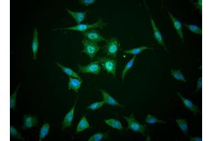 Immunofluorescent staining of human cell lines (TAZ Antikörper)