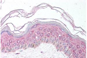 Human Skin (formalin-fixed, paraffin-embedded) stained with MDH1 antibody ABIN291679 at 5 ug/ml followed by biotinylated secondary antibody, alkaline phosphatase-streptavidin and chromogen. (MDH1 Antikörper)