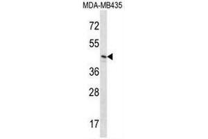 RNH1 Antibody (C-term) western blot analysis in MDA-MB435 cell line lysates (35µg/lane).