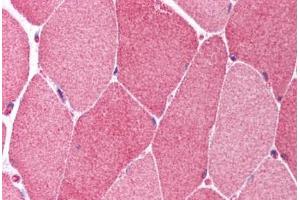 Human Skeletal Muscle (formalin-fixed, paraffin-embedded) stained with BCL10 antibody ABIN214608 at 10 ug/ml followed by biotinylated goat anti-rabbit IgG secondary antibody ABIN481713, alkaline phosphatase-streptavidin and chromogen. (BCL10 Antikörper  (AA 5-19))