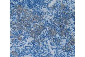 Used in DAB staining on fromalin fixed paraffin- embedded Kidney tissue (IL-2 Antikörper  (AA 21-155))