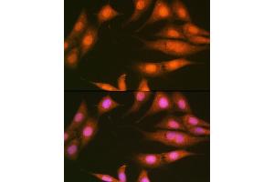 Immunofluorescence (IF) image for anti-Protein Phosphatase 1, Catalytic Subunit, beta Isoform (PPP1CB) antibody (ABIN1679819)