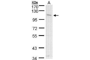 WB Image Sample (30 ug of whole cell lysate) A: A431 , 7. (CLCA1 Antikörper)