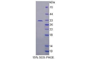 Image no. 1 for ADAM Metallopeptidase Domain 33 (ADAM33) (AA 210-503) protein (His tag) (ABIN4991040) (ADAM33 Protein (AA 210-503) (His tag))