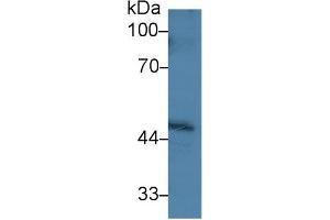 Western Blotting (WB) image for anti-Protein Phosphatase, Mg2+/Mn2+ Dependent, 1A (PPM1A) (AA 2-382) antibody (ABIN7441469)