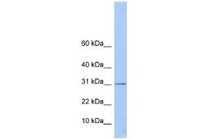 ECHDC1 antibody used at 1 ug/ml to detect target protein.
