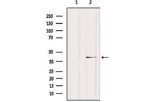 Western blot analysis of extracts from HUVEC, using NCF4 Antibody. (NCF4 Antikörper  (C-Term))