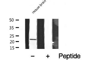 Western blot analysis of extracts from mouse Brian, using CRP1 antibody. (CSRP1 Antikörper  (Internal Region))