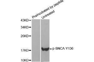Western Blotting (WB) image for anti-Synuclein, alpha (SNCA) (pTyr136) antibody (ABIN1682064) (SNCA Antikörper  (pTyr136))
