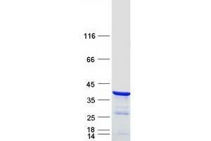 Validation with Western Blot