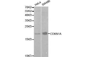 Western blot analysis of extracts of various cell lines, using CDKN1A antibody.