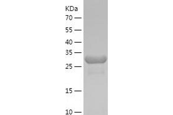 PSME3 Protein (PSME3) (AA 2-254) (His tag)