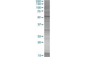 KRT4 transfected lysate. (KRT4 293T Cell Transient Overexpression Lysate(Denatured))