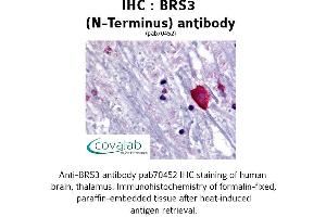 Image no. 1 for anti-Bombesin-Like Receptor 3 (BRS3) (Extracellular Domain), (N-Term) antibody (ABIN1732420) (BRS3 Antikörper  (Extracellular Domain, N-Term))