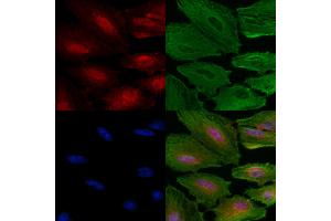 Phospho-SIRT6 (Ser338) Antibody staining A549 cells(4h of LPS treatment) by IF/ICC. (SIRT6 Antikörper  (pSer338))