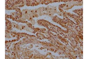 IHC image of ABIN7158304 diluted at 1:300 and staining in paraffin-embedded human lung tissue performed on a Leica BondTM system. (LTC4S Antikörper  (AA 36-51))