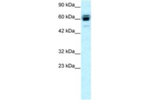 Western Blotting (WB) image for anti-Ring Finger Protein, LIM Domain Interacting (RLIM) antibody (ABIN2460384) (RLIM Antikörper)