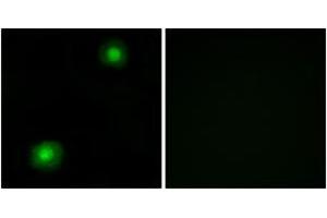 Immunofluorescence analysis of A549 cells, using ZNF187 Antibody. (ZNF187 Antikörper  (AA 51-100))