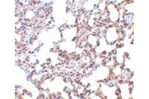 Immunohistochemistry of SKIL in mouse lung tissue with SKIL polyclonal antibody  at 5 ug/mL .