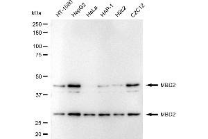 Western blotting analysis using MBD2 antibody (ABIN7799387). (Rekombinanter MBD2 Antikörper)