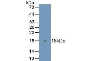 Detection of Recombinant TP63, Human using Monoclonal Antibody to Tumor Protein P63 (TP63) (p63 Antikörper  (AA 540-680))