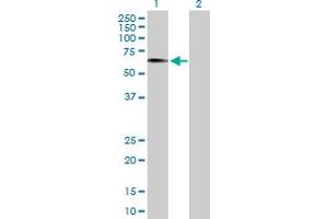 Western Blot analysis of EGR2 expression in transfected 293T cell line by EGR2 MaxPab polyclonal antibody. (EGR2 Antikörper  (AA 1-476))