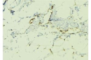ABIN6276411 at 1/100 staining Human lung tissue by IHC-P. (ILK Antikörper  (C-Term))