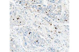 IHC analysis of CD68 using anti-CD68 antibody (ABIN7600142). (CD68 Antikörper  (AA 154-354))